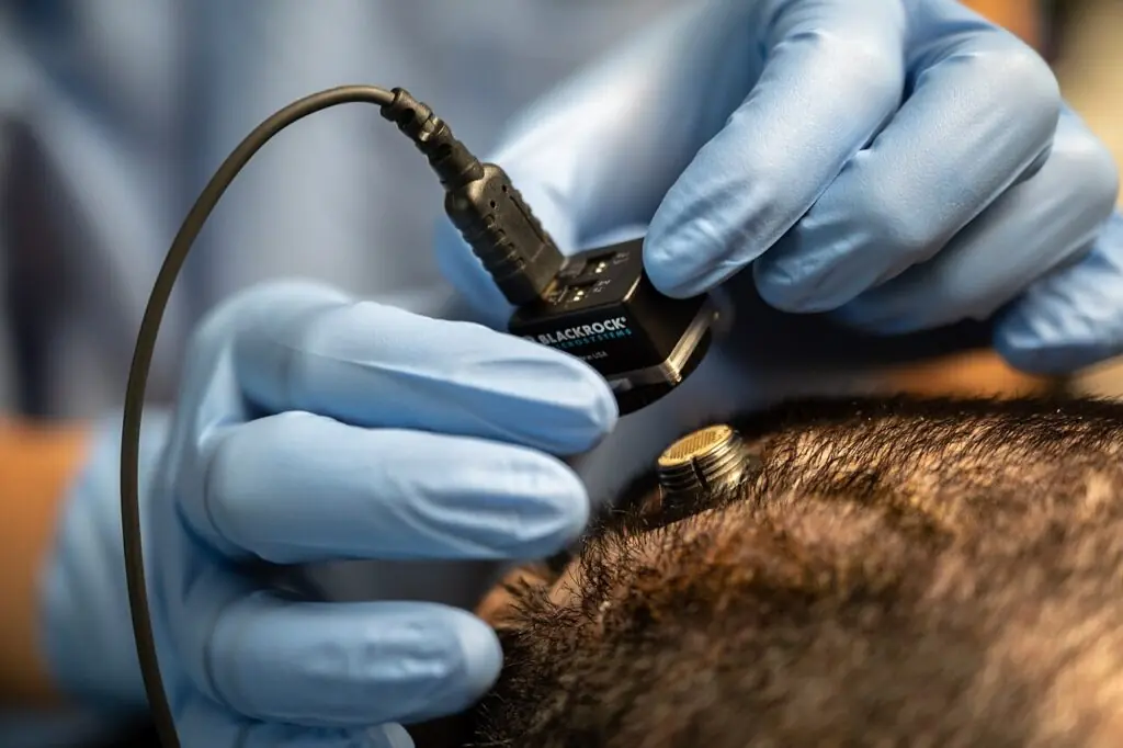 Dr. Eddie Chang, a neurosurgeon and Chairman of the Department of Neurological Surgery at UCSF Medical School, prepares to connect an experimental medical breakthrough brain implant which will help a paralyzed patient "Bravo1" speak by reading his brain signals. 5 July 2021. Mike Cai Chen, photographer